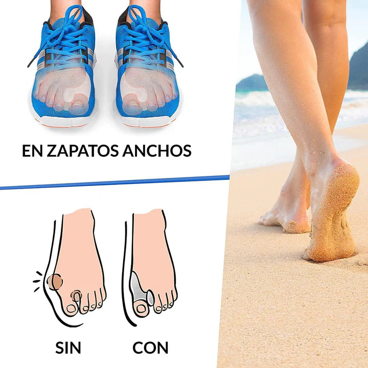 Corrector de Juanetes - Valgus